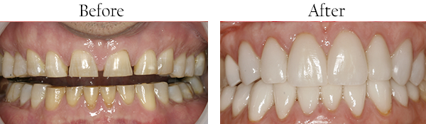 dental images 11803